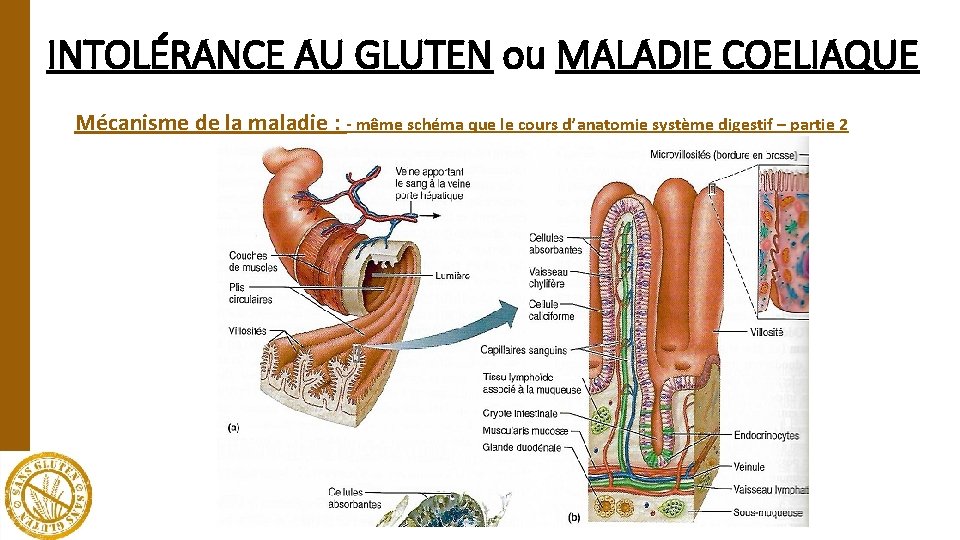 INTOLÉRANCE AU GLUTEN ou MALADIE COELIAQUE Mécanisme de la maladie : - même schéma