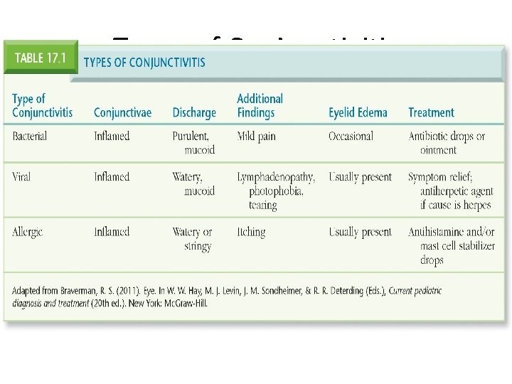 Types of Conjunctivitis Adapted from Braverman, R. S. (2011). Eye. In W. W. Hay,