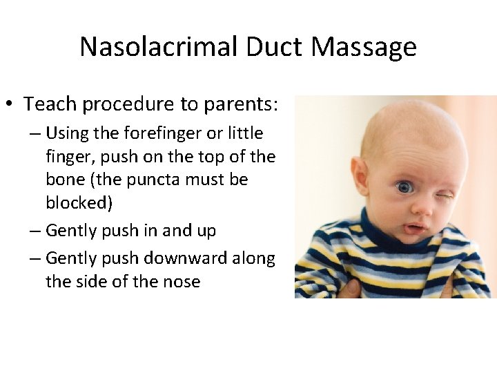 Nasolacrimal Duct Massage • Teach procedure to parents: – Using the forefinger or little