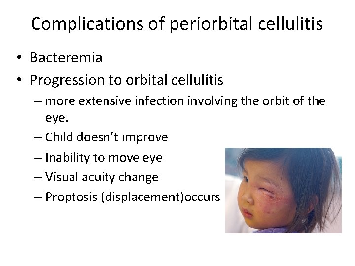 Complications of periorbital cellulitis • Bacteremia • Progression to orbital cellulitis – more extensive