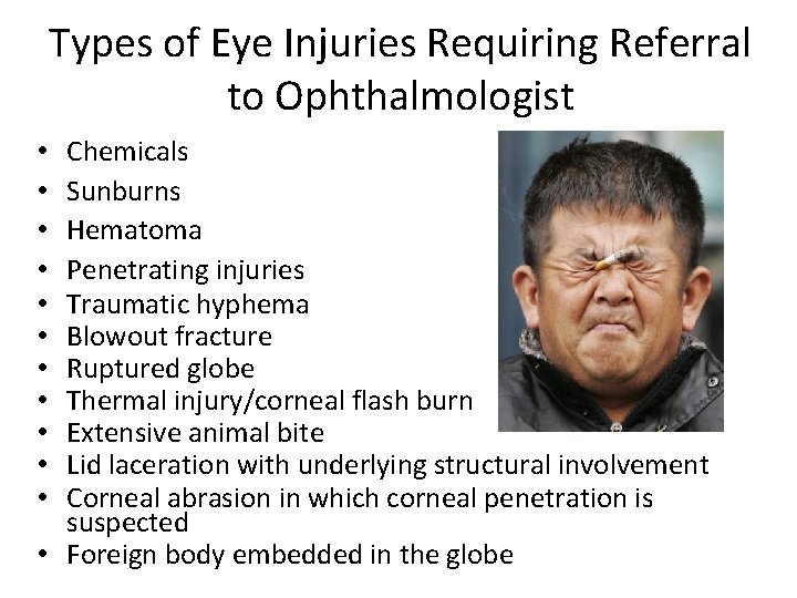 Types of Eye Injuries Requiring Referral to Ophthalmologist Chemicals Sunburns Hematoma Penetrating injuries Traumatic