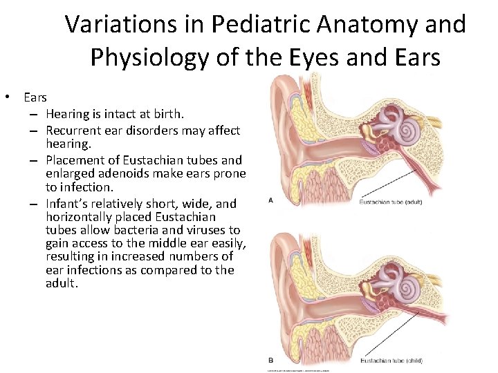 Variations in Pediatric Anatomy and Physiology of the Eyes and Ears • Ears –