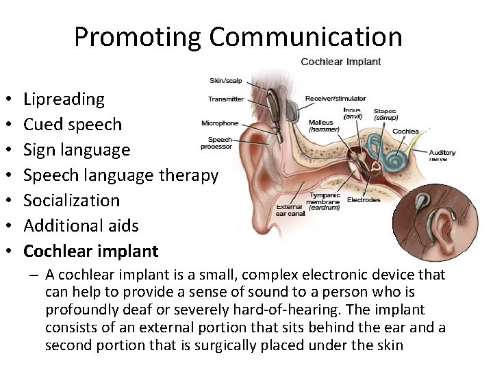 Promoting Communication • • Lipreading Cued speech Sign language Speech language therapy Socialization Additional