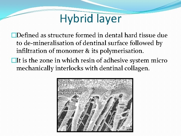 Hybrid layer �Defined as structure formed in dental hard tissue due to de-mineralisation of