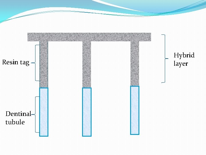 Resin tag Dentinal tubule Hybrid layer 