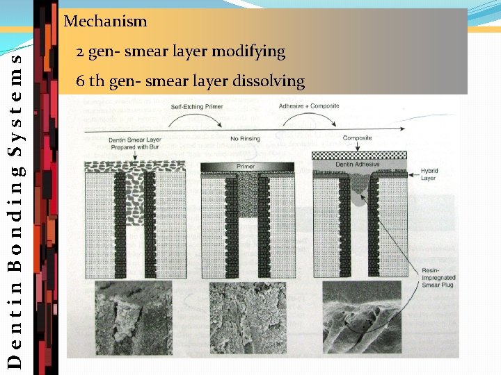 Dentin Bonding Systems Mechanism 2 gen- smear layer modifying 6 th gen- smear layer