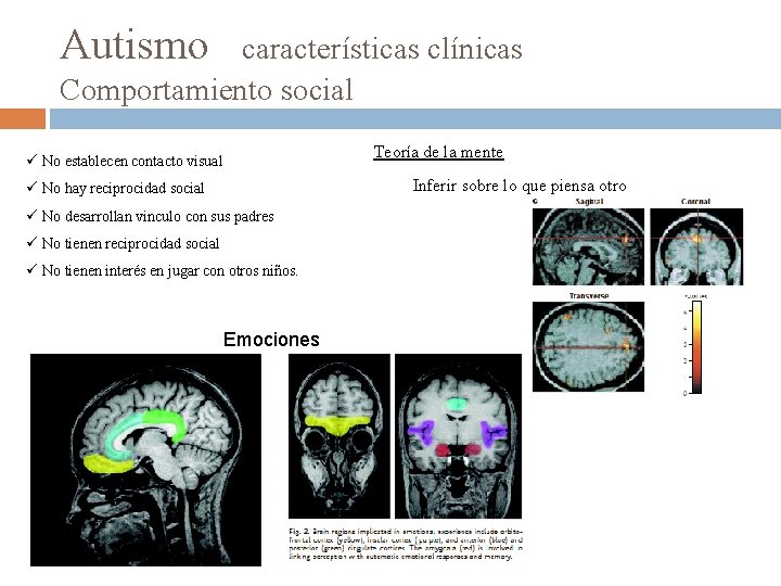 Autismo características clínicas Comportamiento social Teoría de la mente ü No establecen contacto visual