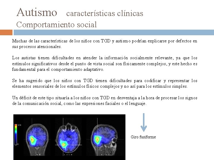 Autismo características clínicas Comportamiento social Muchas de las características de los niños con TGD