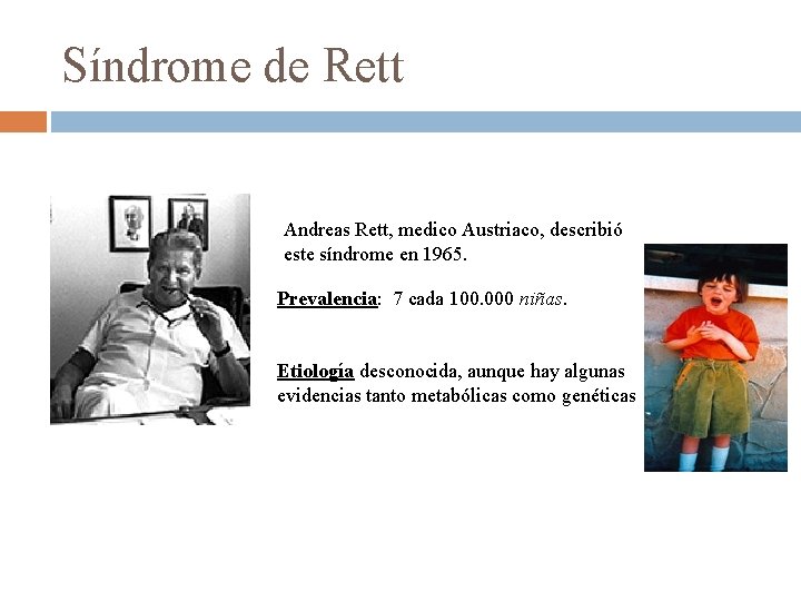 Síndrome de Rett Andreas Rett, medico Austriaco, describió este síndrome en 1965. Prevalencia: 7