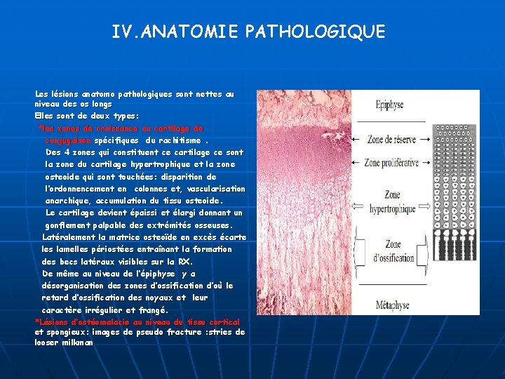 IV. ANATOMIE PATHOLOGIQUE Les lésions anatomo pathologiques sont nettes au niveau des os longs