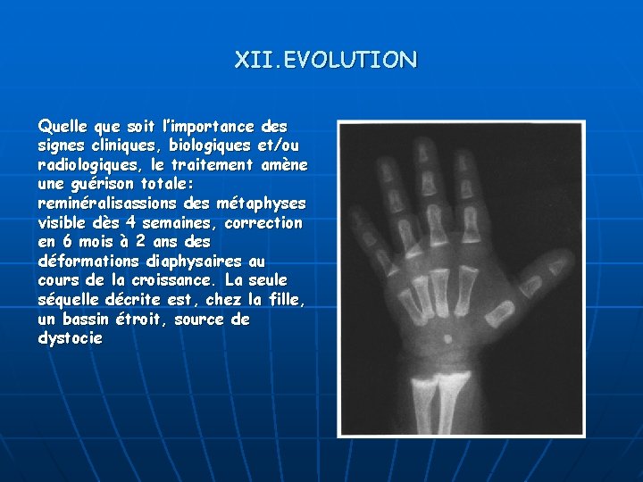 XII. EVOLUTION Quelle que soit l’importance des signes cliniques, biologiques et/ou radiologiques, le traitement