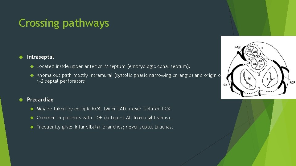 Crossing pathways Intraseptal Located inside upper anterior IV septum (embryologic conal septum). Anomalous path