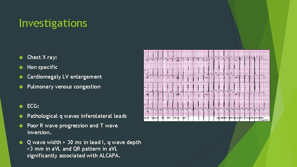 Investigations Chest X ray: Non specific Cardiomegaly LV enlargement Pulmonary venous congestion ECG: Pathological