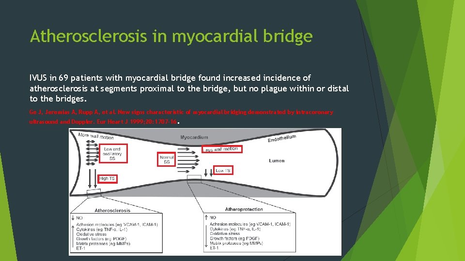 Atherosclerosis in myocardial bridge IVUS in 69 patients with myocardial bridge found increased incidence