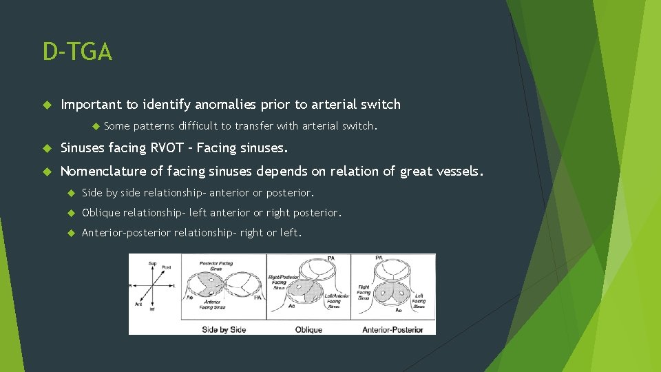 D-TGA Important to identify anomalies prior to arterial switch Some patterns difficult to transfer
