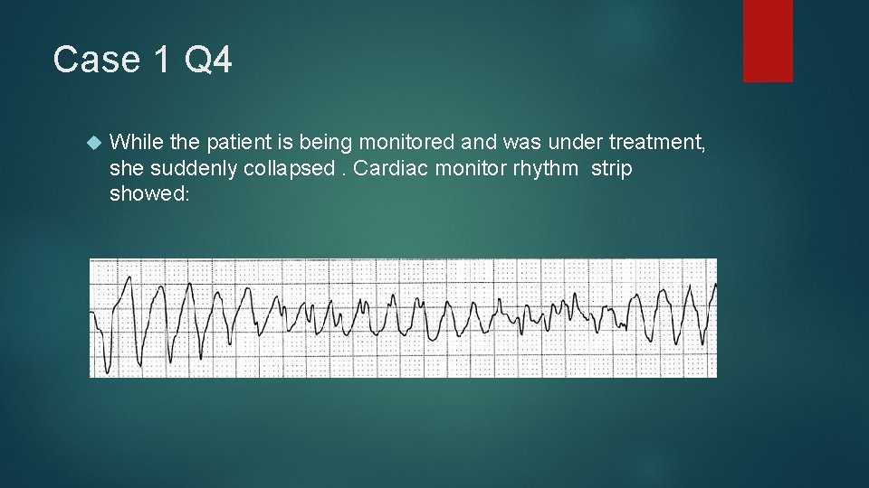 Case 1 Q 4 While the patient is being monitored and was under treatment,