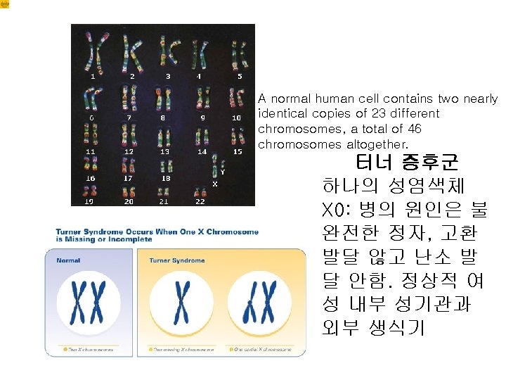 A normal human cell contains two nearly identical copies of 23 different chromosomes, a
