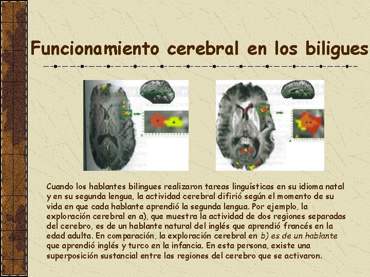 Funcionamiento cerebral en los biligues Cuando los hablantes bilingues realizaron tareas linguísticas en su