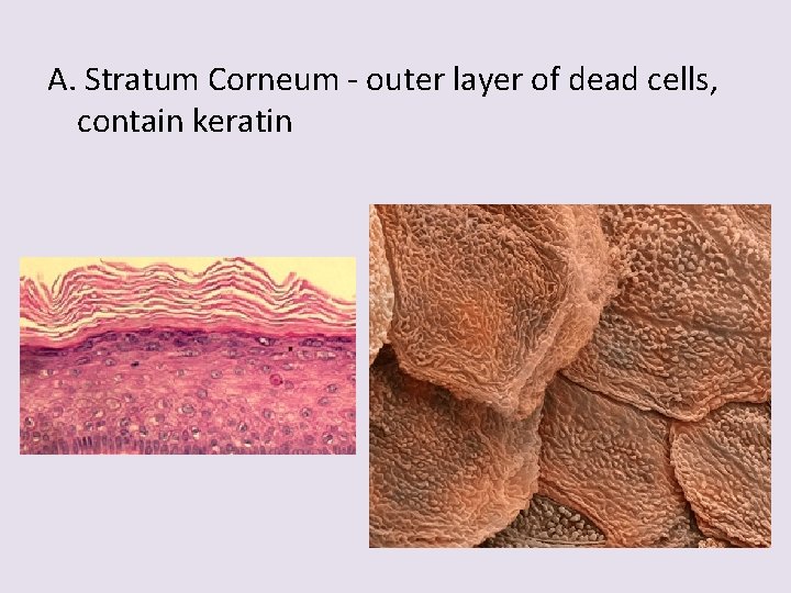 A. Stratum Corneum - outer layer of dead cells, contain keratin 