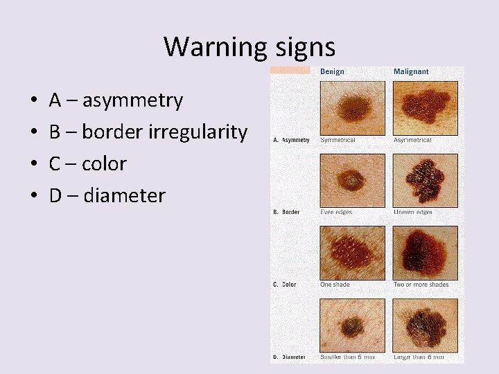 Warning signs • • A – asymmetry B – border irregularity C – color