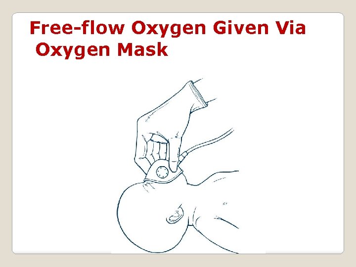 Free-flow Oxygen Given Via Oxygen Mask 