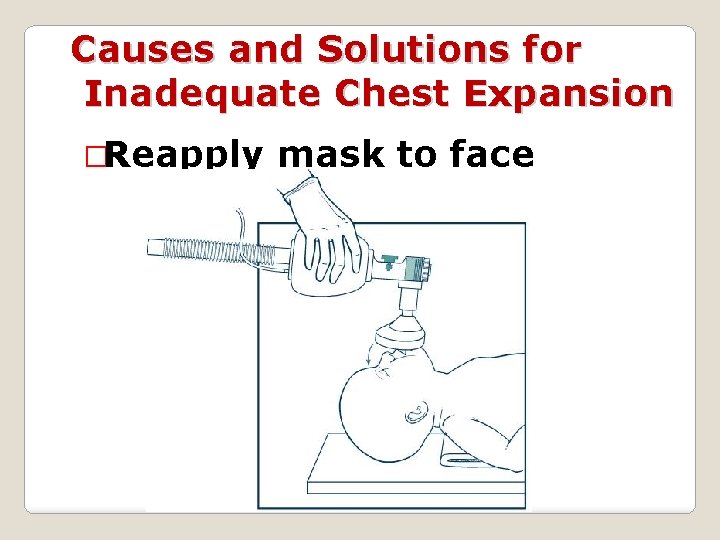 Causes and Solutions for Inadequate Chest Expansion �Reapply mask to face 