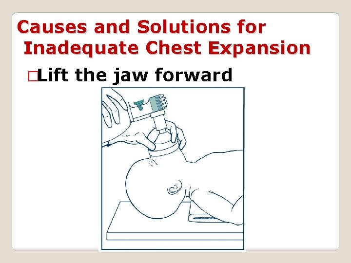 Causes and Solutions for Inadequate Chest Expansion �Lift the jaw forward 