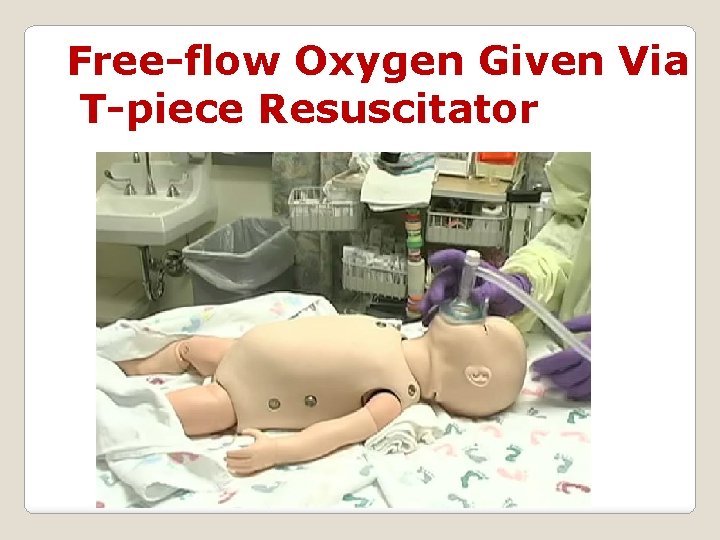 Free-flow Oxygen Given Via T-piece Resuscitator 