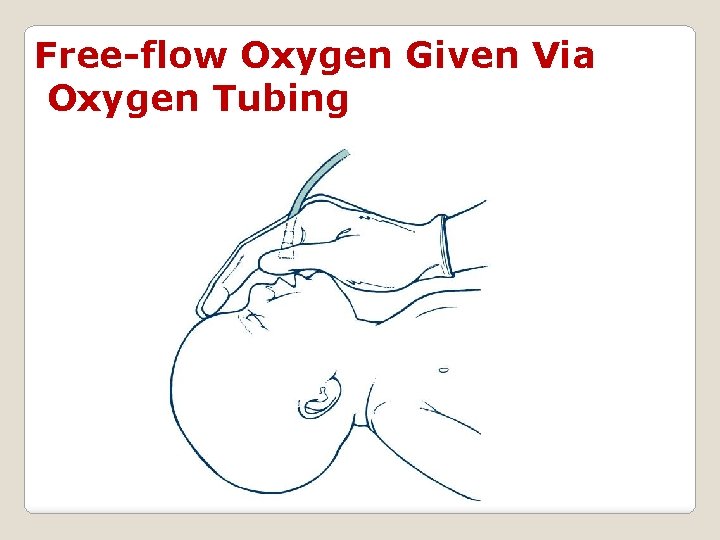 Free-flow Oxygen Given Via Oxygen Tubing 