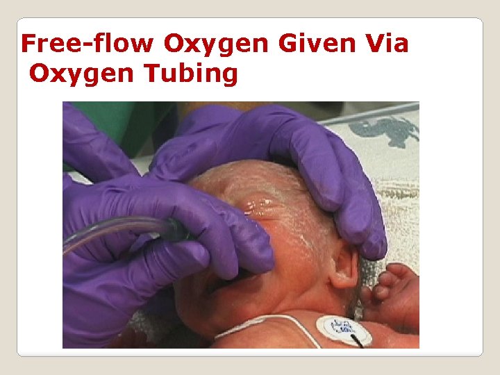 Free-flow Oxygen Given Via Oxygen Tubing 