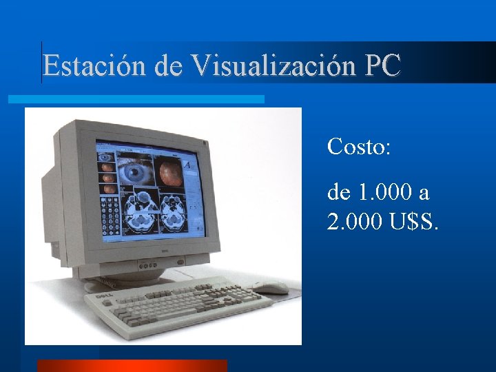 Estación de Visualización PC Costo: de 1. 000 a 2. 000 U$S. 