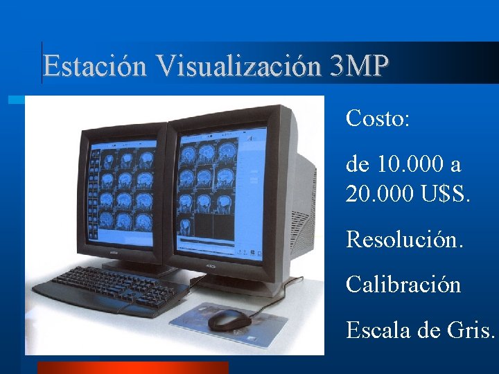 Estación Visualización 3 MP Costo: de 10. 000 a 20. 000 U$S. Resolución. Calibración