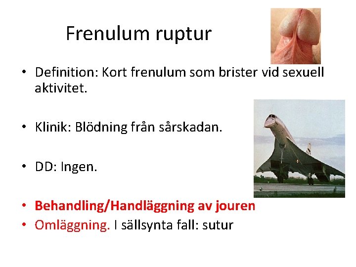 Frenulum ruptur • Definition: Kort frenulum som brister vid sexuell aktivitet. • Klinik: Blödning