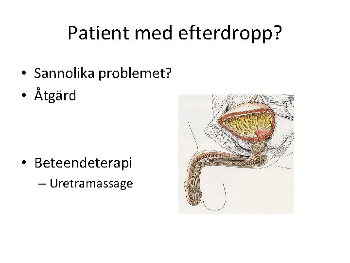 Patient med efterdropp? • Sannolika problemet? • Åtgärd • Beteendeterapi – Uretramassage 