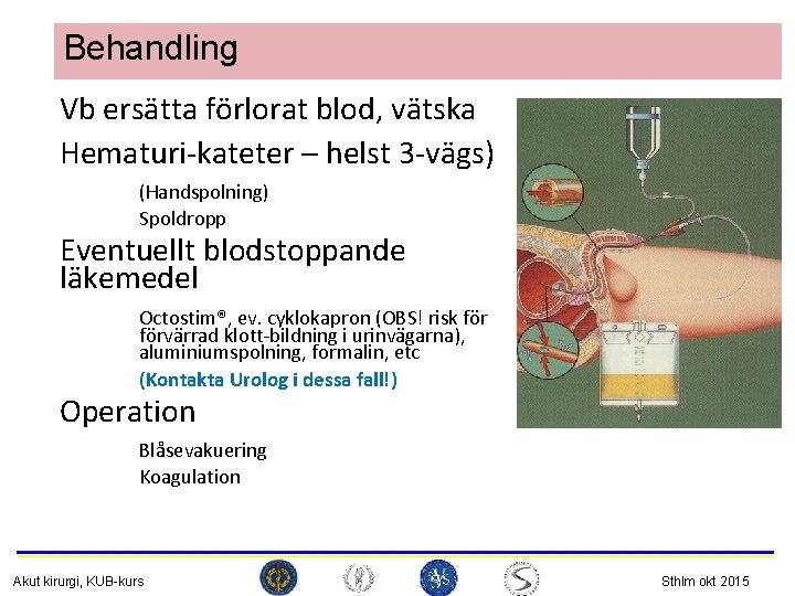 Behandling Vb ersätta förlorat blod, vätska Hematuri-kateter – helst 3 -vägs) (Handspolning) Spoldropp Eventuellt