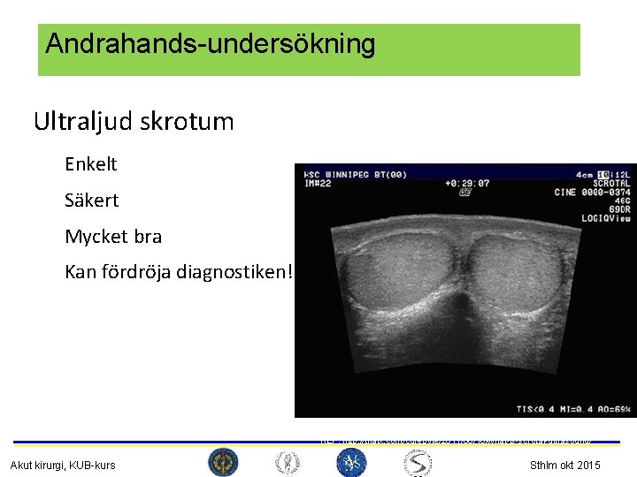 Andrahands-undersökning Ultraljud skrotum Enkelt Säkert Mycket bra Kan fördröja diagnostiken! REF: http: //trialx. com/curebyte/2011/08/16/what-is-scrotal-ultrasound/