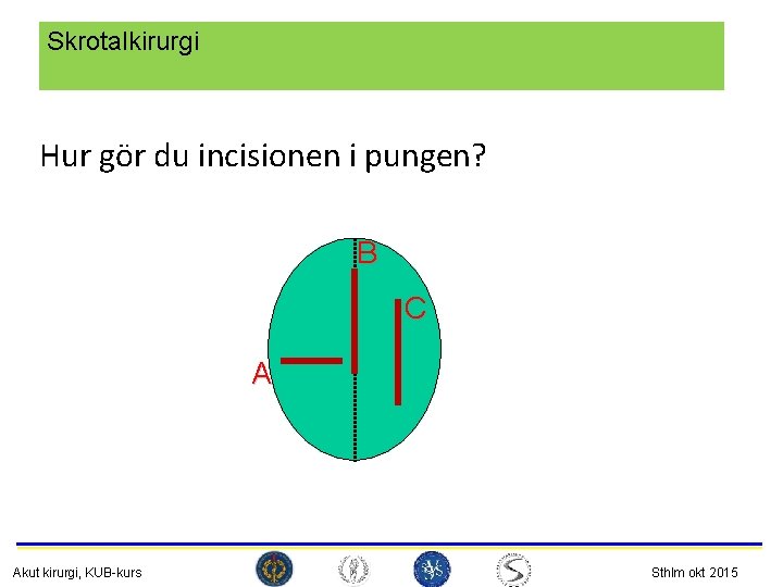Skrotalkirurgi Hur gör du incisionen i pungen? B C A Akut kirurgi, KUB-kurs Sthlm