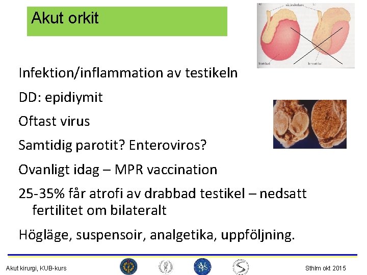 Akut orkit Infektion/inflammation av testikeln DD: epidiymit Oftast virus Samtidig parotit? Enteroviros? Ovanligt idag