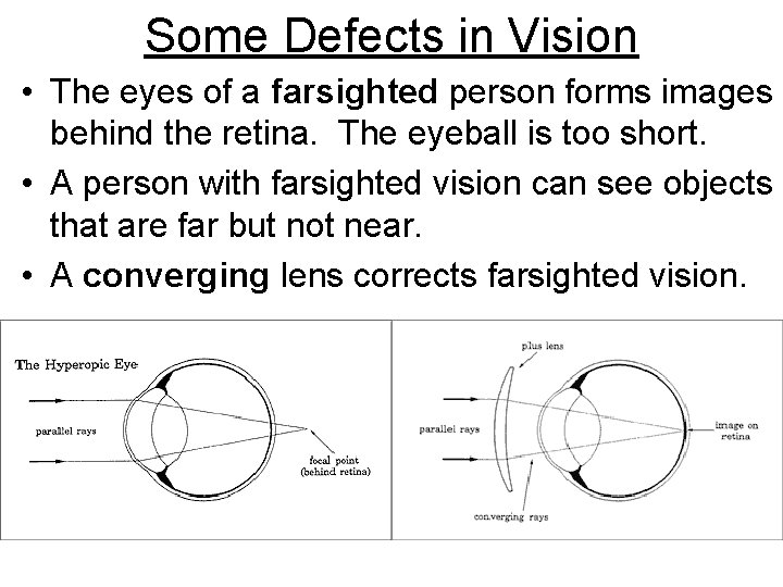 Some Defects in Vision • The eyes of a farsighted person forms images behind