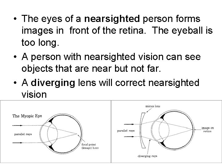  • The eyes of a nearsighted person forms images in front of the