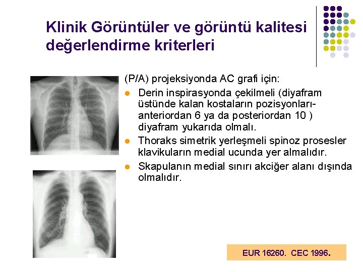 Klinik Görüntüler ve görüntü kalitesi değerlendirme kriterleri (P/A) projeksiyonda AC grafi için: l Derin