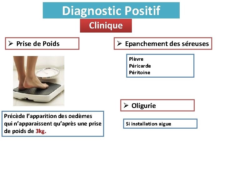 Diagnostic Positif Clinique Ø Prise de Poids Ø Epanchement des séreuses Plèvre Péricarde Péritoine