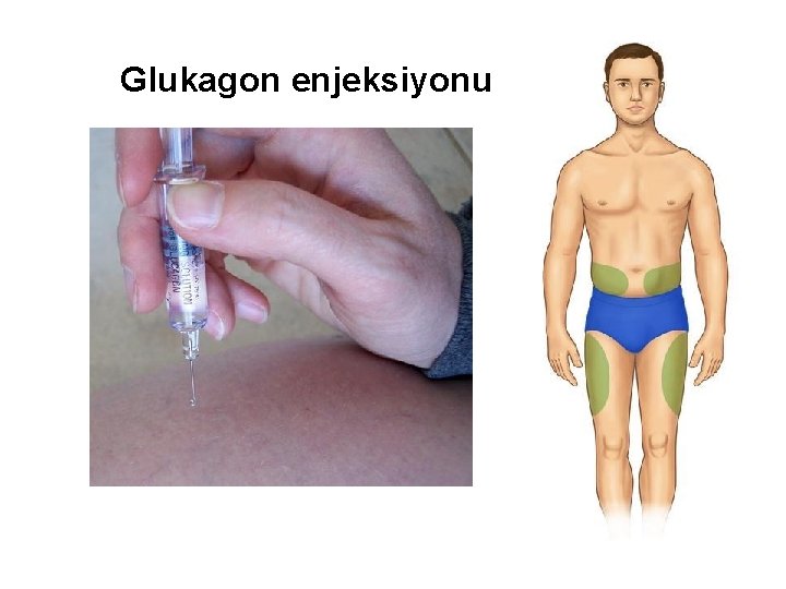 Glukagon enjeksiyonu 