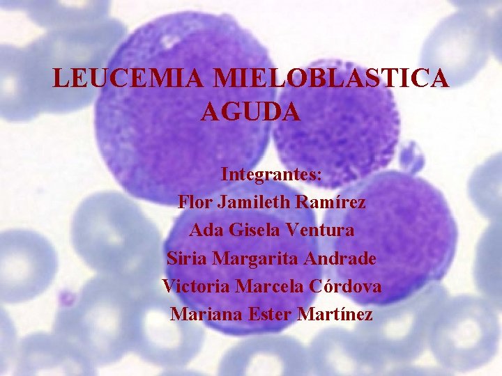 LEUCEMIA MIELOBLASTICA AGUDA Integrantes: Flor Jamileth Ramírez Ada Gisela Ventura Siria Margarita Andrade Victoria