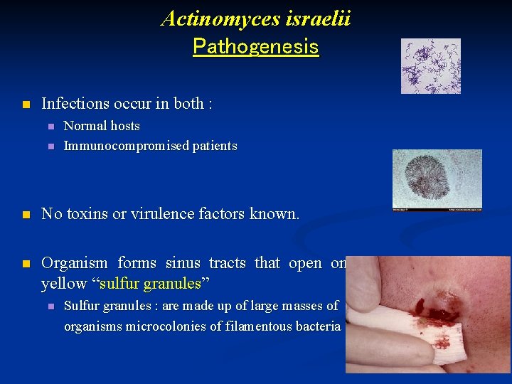 Actinomyces israelii Pathogenesis n Infections occur in both : n n Normal hosts Immunocompromised