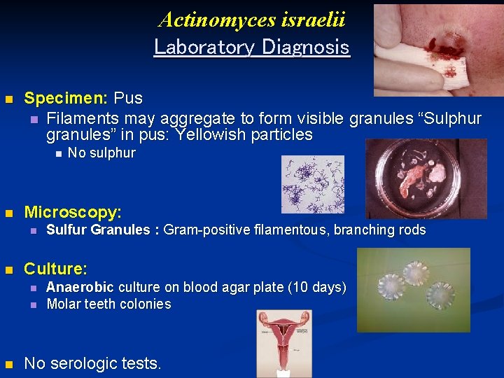 Actinomyces israelii Laboratory Diagnosis n Specimen: Pus n Filaments may aggregate to form visible