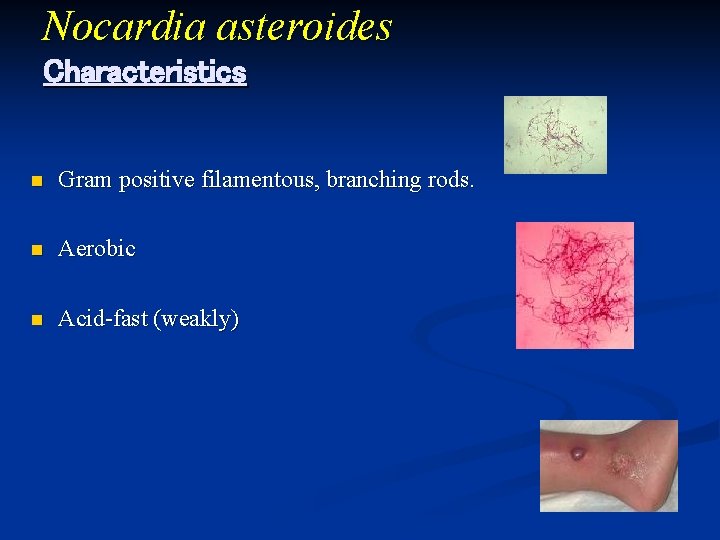 Nocardia asteroides Characteristics n Gram positive filamentous, branching rods. n Aerobic n Acid-fast (weakly)