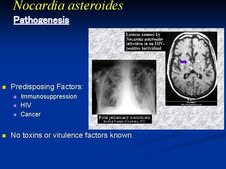 Nocardia asteroides Pathogenesis n Predisposing Factors: n n Immunosuppression HIV Cancer No toxins or