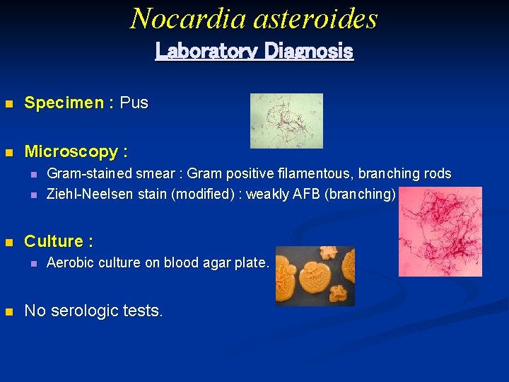 Nocardia asteroides Laboratory Diagnosis n Specimen : Pus n Microscopy : n n n