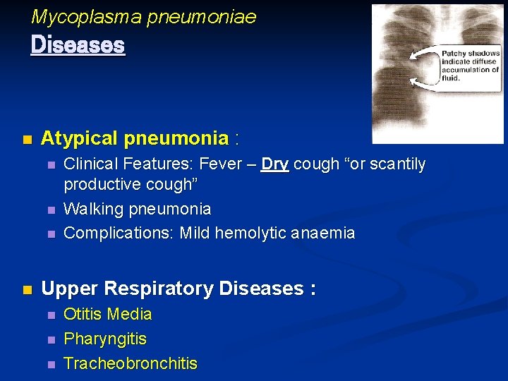 Mycoplasma pneumoniae Diseases n Atypical pneumonia : n n Clinical Features: Fever – Dry